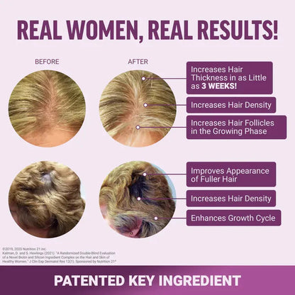 FemmiGlow Hair Growth Accelerator Gummies
