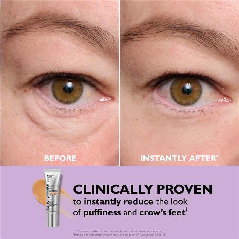 Instant Eye Tightener – Firm & Smooth Skin in Seconds